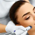 Microdermoabrasione: Cos'è? Funziona? Fai da Te