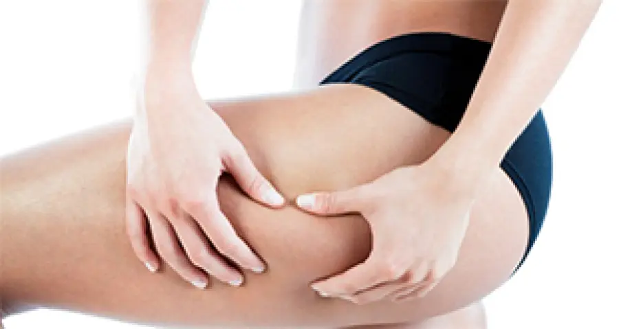 Come togliere la cellulite