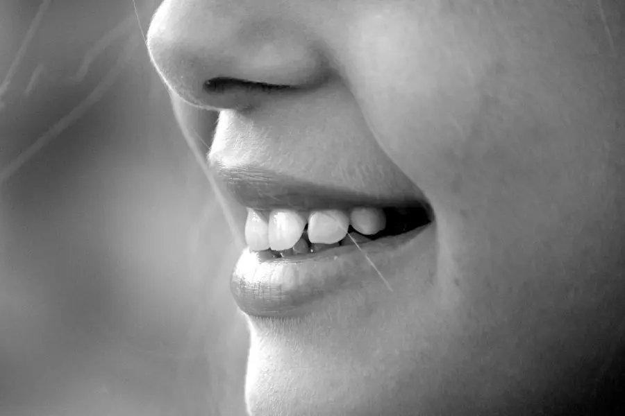 Sbiancamento denti: tutti i trattamenti disponibili