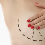 Mastoplastica additiva: cosa sapere su questo intervento di chirurgia estetica
